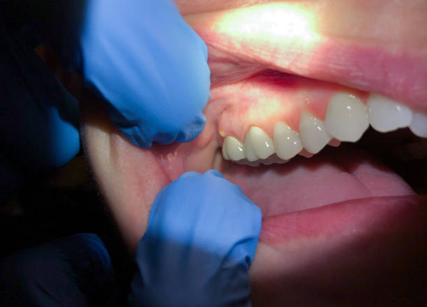 Best Emergency TMJ Treatment in Pacheco, CA
