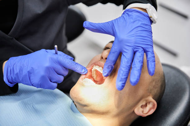 Best Emergency Dental Care for Broken or Chipped Teeth in Pacheco, CA