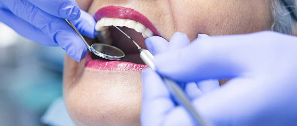Best Emergency Gum Treatment in Pacheco, CA